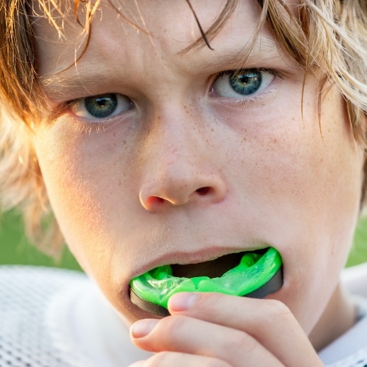 Teen placing an athletic mouthguard